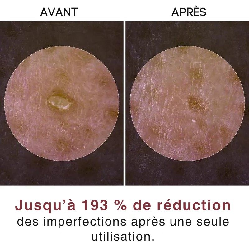 Duo d’Ampoules Exfoliantes au Riz par Ardencia