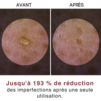 Duo d’Ampoules Exfoliantes au Riz par Ardencia
