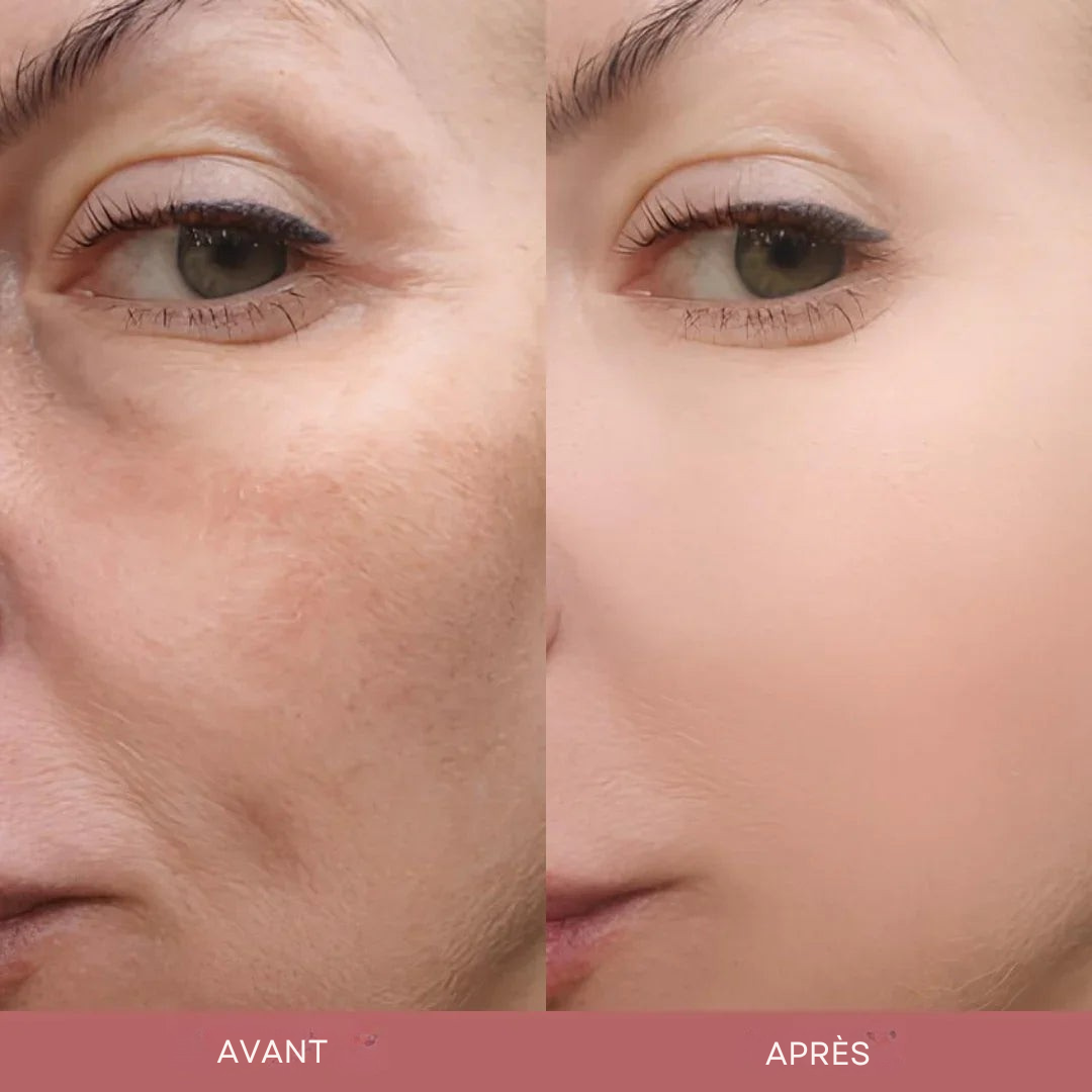 Duo d’Ampoules Exfoliantes au Riz par Ardencia